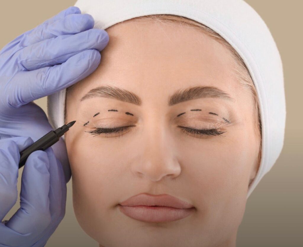 Selfies e videoconferências aumentaram a procura por cirurgias faciais? 3 cirurgia do olhar